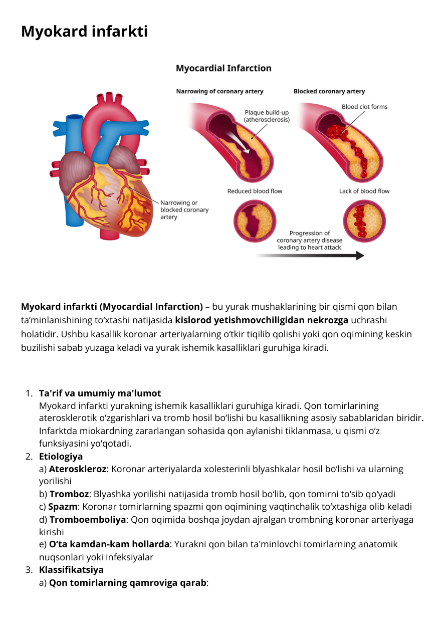Myokard infarkti