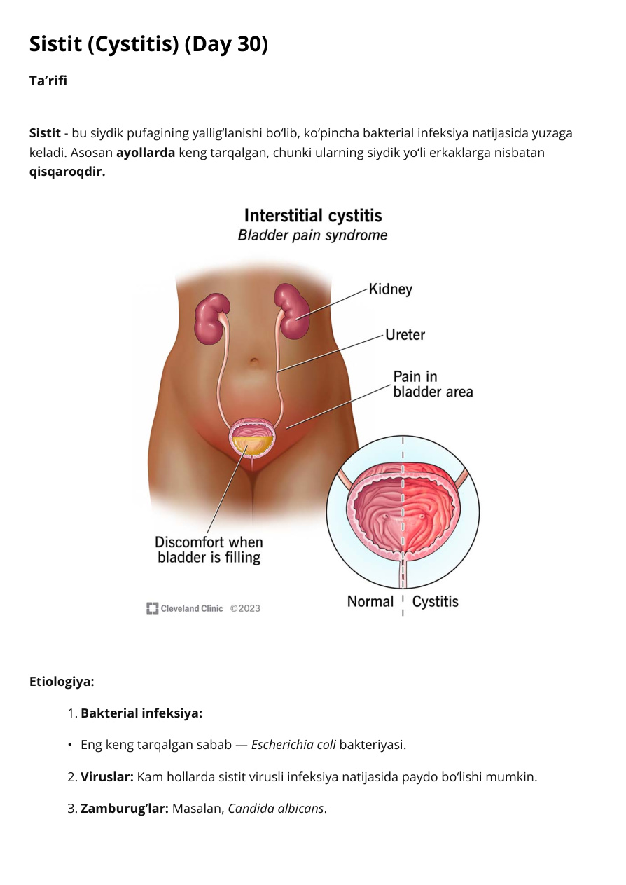 Sistit (Cystitis) (Day 30)