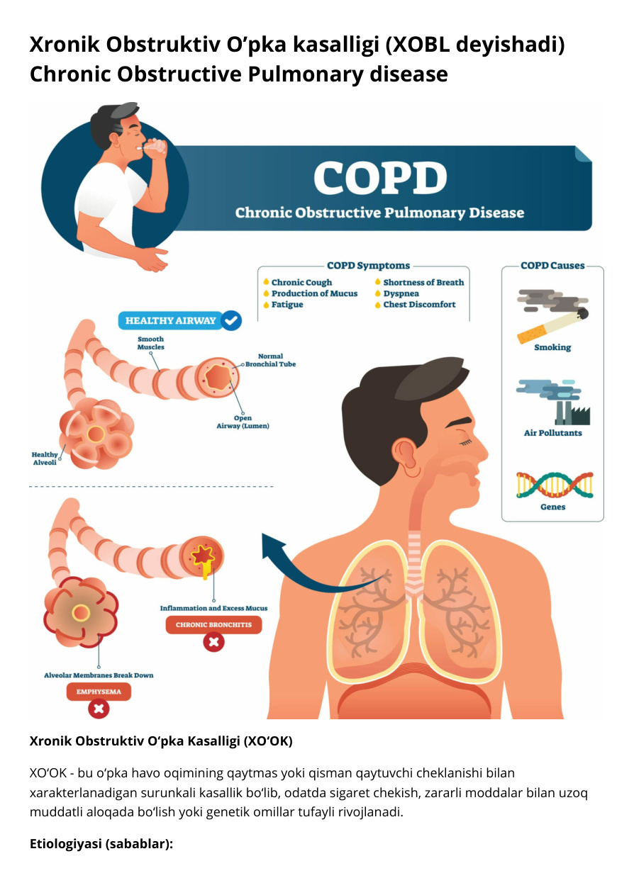 Xronik_Obstruktiv_O’pka_kasalligi_XOBL_Chronik_Obstructive_Pulmonary